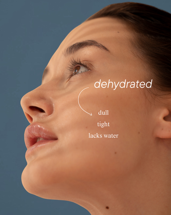 Dehydrated Skin vs Dry Skin: How to Tell the Difference and Restore Balance