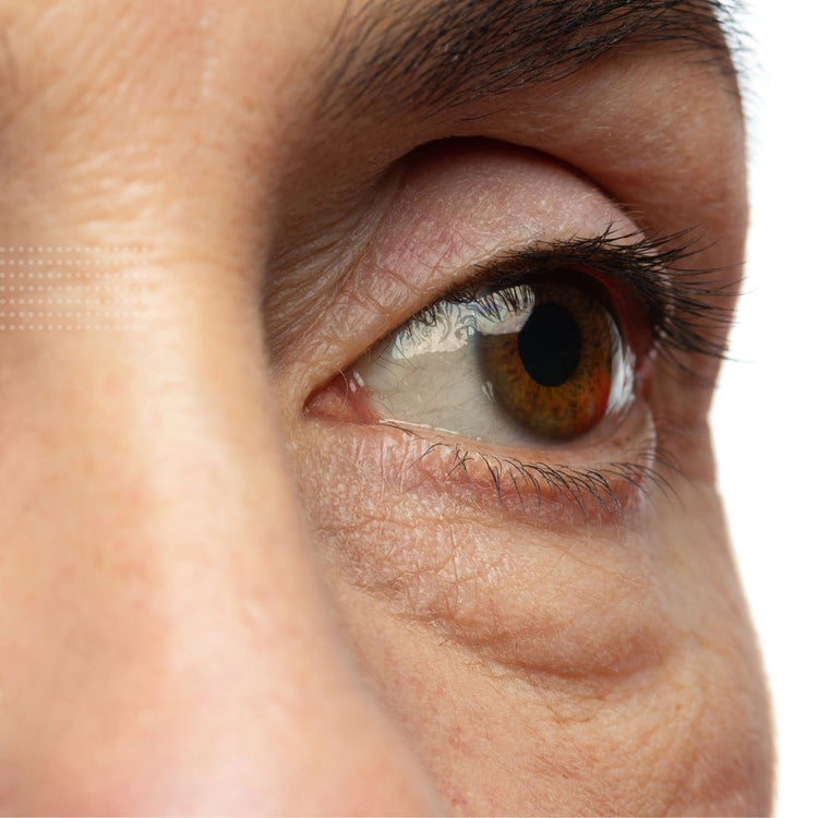 Secrets to Refreshed and Revitalized Under-Eye Area with Advanced Skin ...