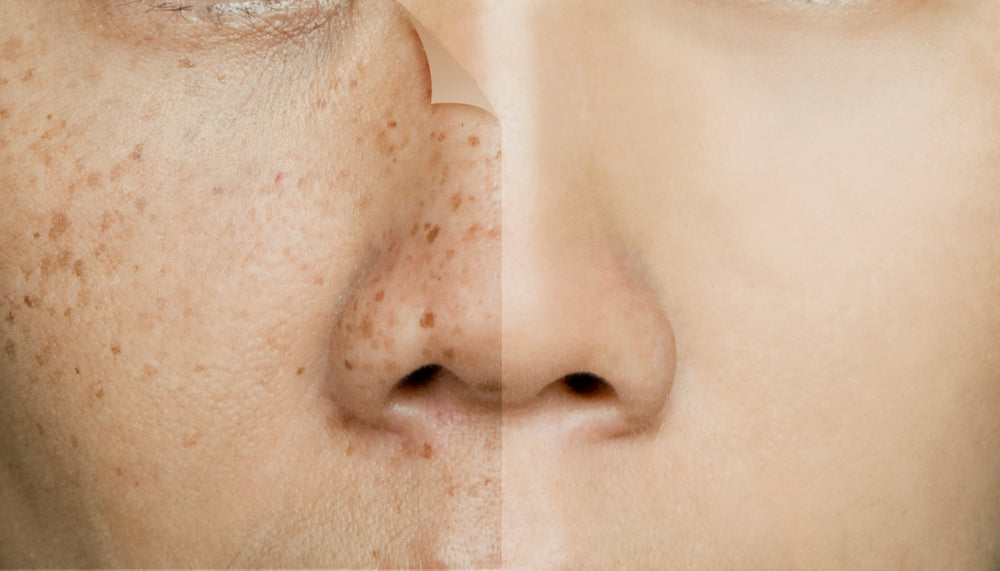 A beginner's guide to Niacinamide. The Vitamin B3 your skin has been craving.
